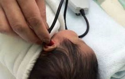 Importância do teste da orelhinha nos bebês recém-nascidos