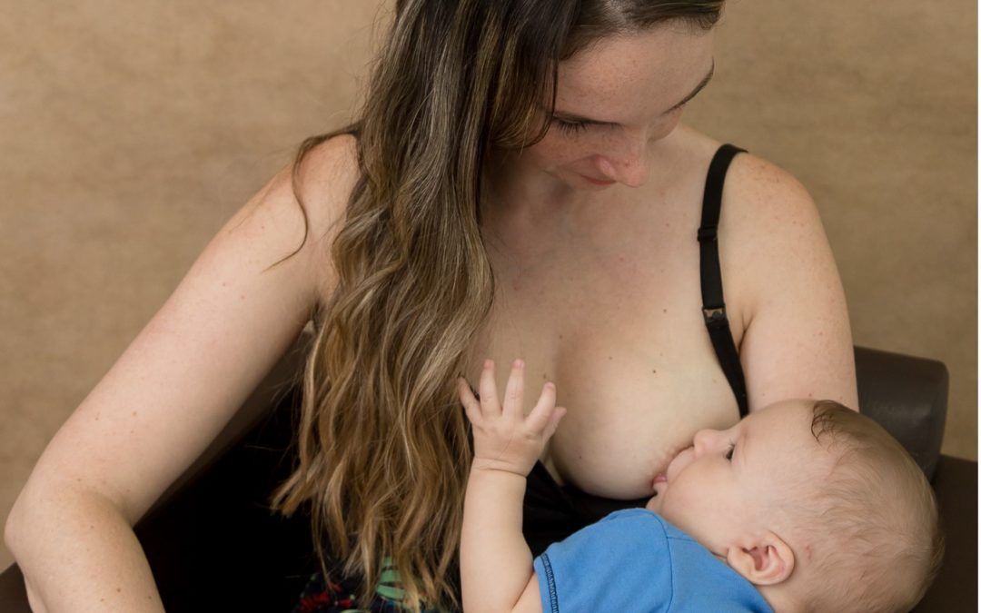 Candidíase mamária e o Aleitamento Materno