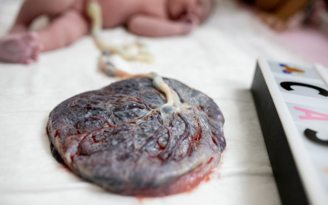 Placenta Prévia é indicação de cesárea?